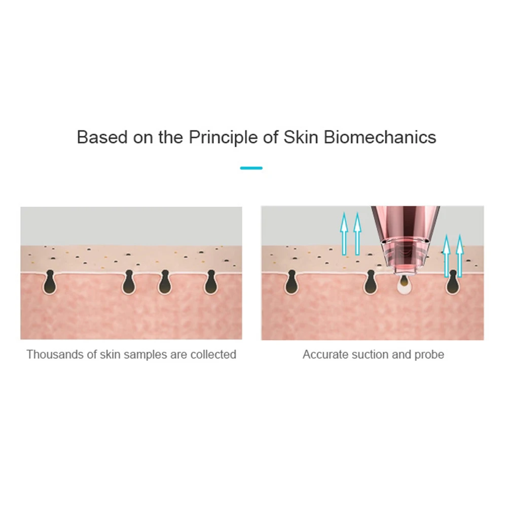 Электрический вакуумный аппарат для очистки пор Нос лицо глубокое очищение кожи