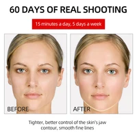 Masażer twarzy EMS Lifting światłoterapia LED mezoterapia usuwanie zmarszczek częstotliwość radiowa napinanie skóry maszyna do liftingu twarzy 6