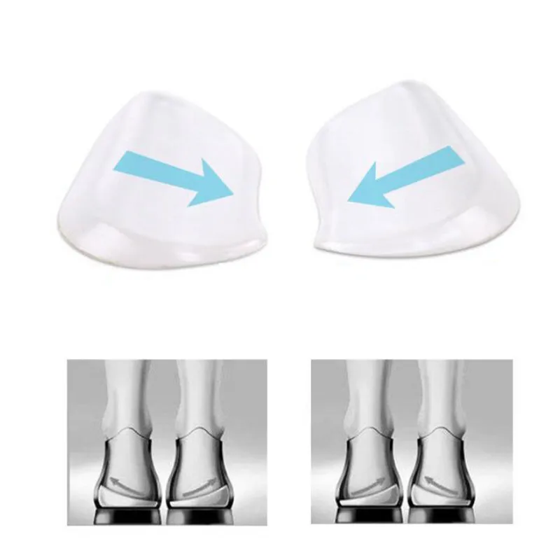 2 шт. Силиконовые ортопедические стельки для обуви X/O-типа | Обувь
