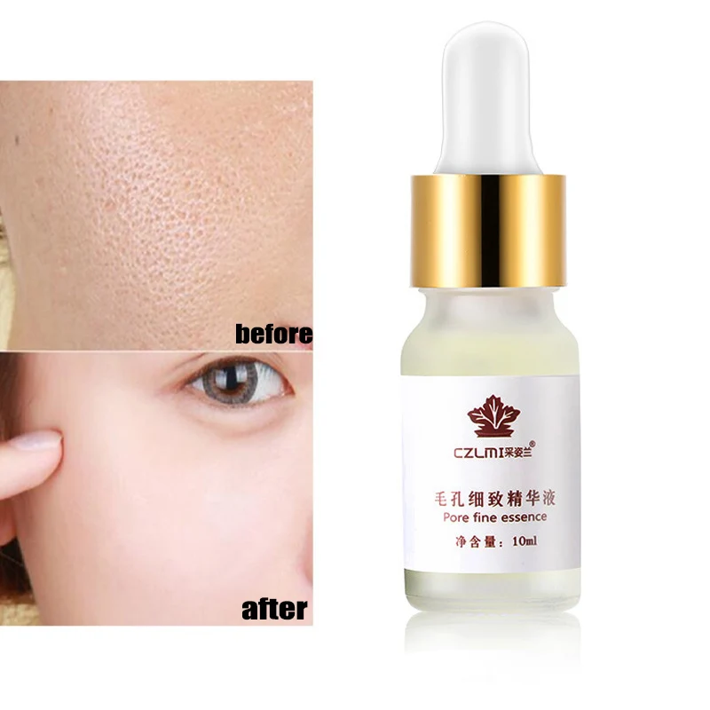 Увлажняющий отбеливающий крем для лица с гиалуроновой кислотой сужение пор 10