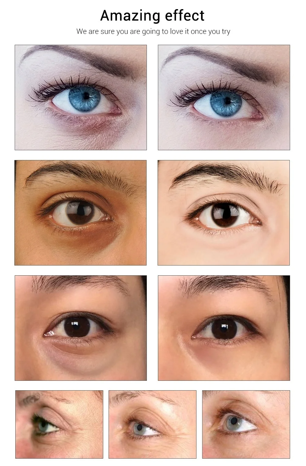 FTEENPLY 24K Золотая маска для глаз коллагеновые патчи для глаз темный круг Eyebag против старения морщин подтягивающий увлажняющий уход за кожей 5 пар
