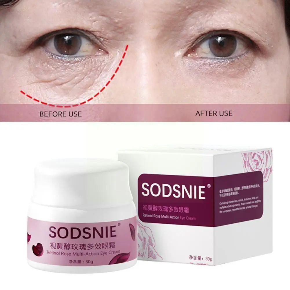 

Anti Dark Circle Eyes Care Cream Dark Circles Fade Collagen Anti Serum Lines Wrinkle Nourishing Cream Fine Whitening Anti A O8R9