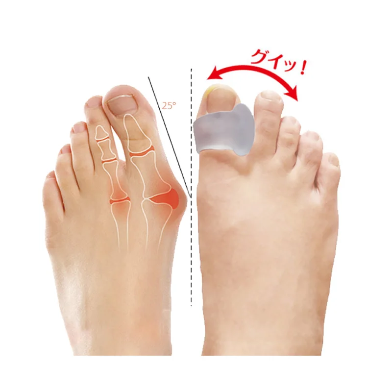 

2Pcs=1Pair Silicone Gel Big Toe Separator Bunion Adjuster Foot Fingers Protector Bone Hallux Valgus Corrector Foot Care Pedicure