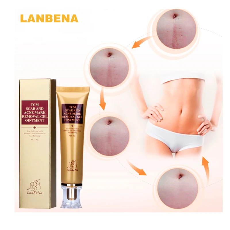 LANBENA Acne Scar Removal Cream Skin Repair Face Spots Treatment Blackhead Whitening Stretch Marks 30ml | Красота и здоровье