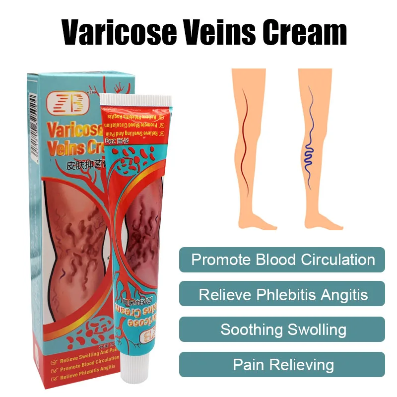 

20g Varicose Veins Treatment Phlebitis Varicosity Angiitis Ointment Remove Spider Legs Veins Pain Medical Plaster