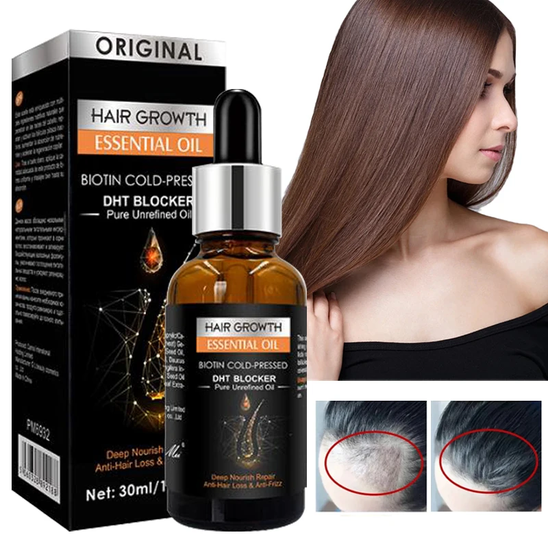 

Hair Growth Shampoo Essential Oil Ginger Scalp Treatment Dense Anti Hair Loss Anti Itching Nourishing Supple Care 30ml/250ml