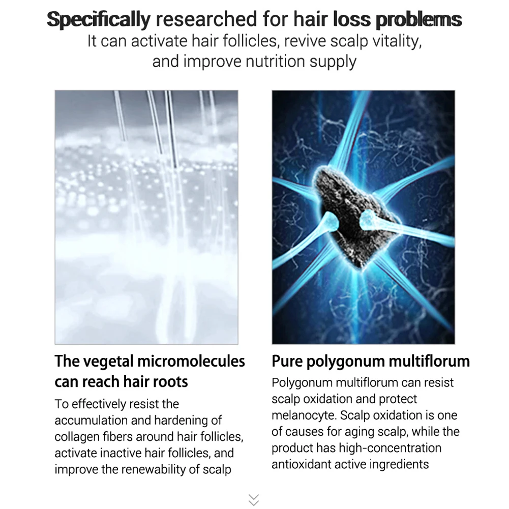 Спрей LANBENA эссенция для быстрого роста волос предотвращающий питание корней