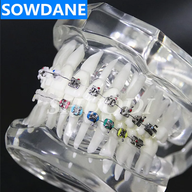 Стоматологическая Ортодонтическая модель 4 вида кронштейнов с керамическим