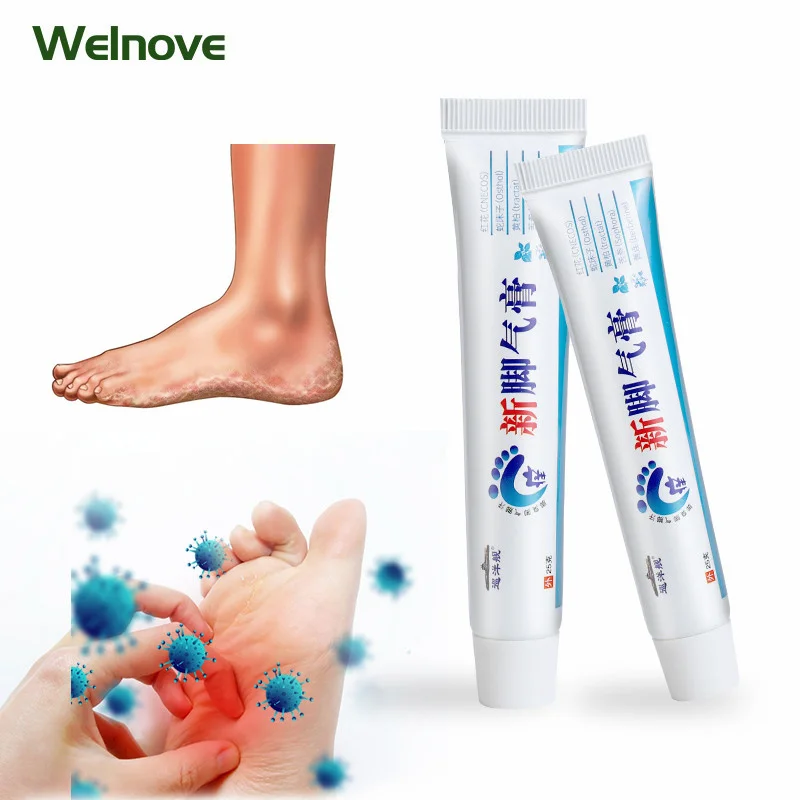 

1pc 25g Feet Psoriasis Eczema Cream Antibacterial Dermatitis Pruritus Beriberi Rotten Peeling Anti-itching Odor Medical Ointment