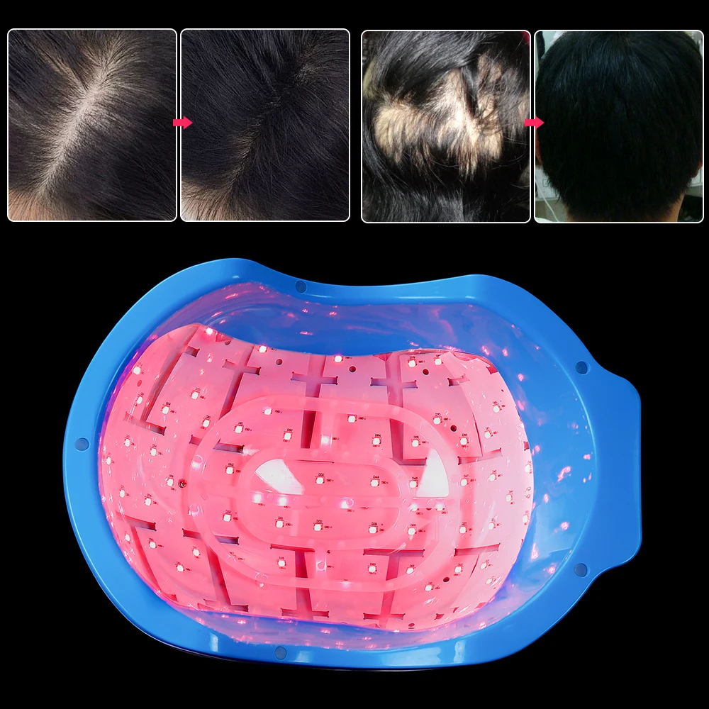 Лазерный шлем для восстановления волос с защитой от выпадения защита роста