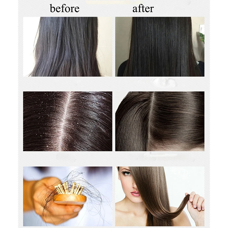 

BOQIAN Shampoo & Hair Conditioner Scalp Hair Treatment Ginger Hair Care Sets Anti Hair Loss Repair Damaged Anti-Dandruff 500MLx2