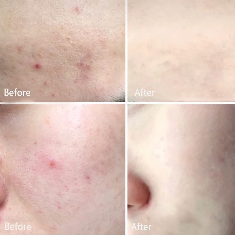 Прямая поставка красивая глазурованная основа для макияжа Праймер консилер