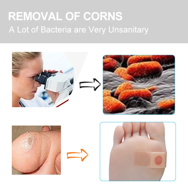 90 шт. пластыри для удаления мозолей на ногах | Красота и здоровье