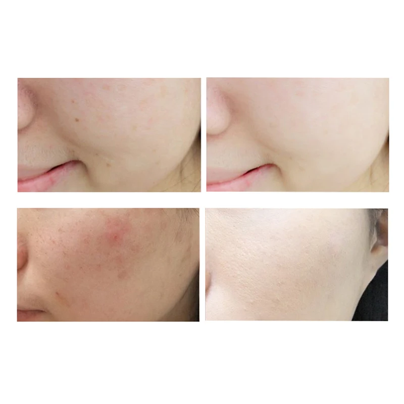 30 мл косметический увлажняющий крем Основа мягкая длинная одежда контроль