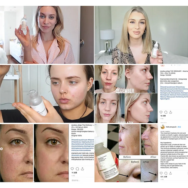 Обычный никотинамид 10% + Цинк 1% высокое минеральное эссенция регулирует