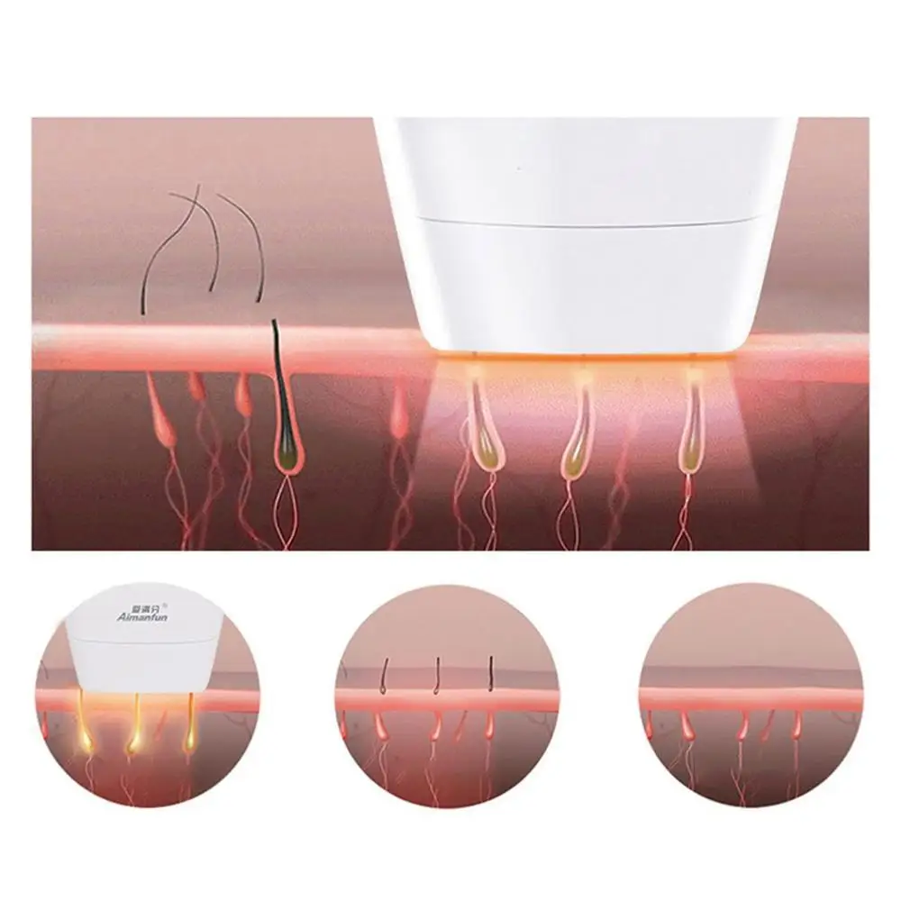 Professional Permanent IPL Laser Epilator Hair Removal Photo Women Painless Threading Machine Electric Body Remover Device | Красота и