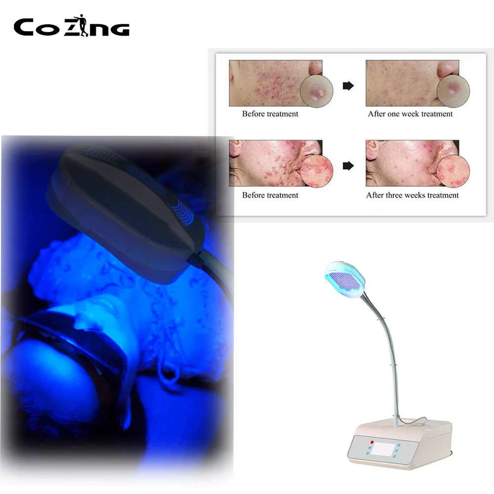 

Wound healing PDT led for skin rejuvenation photon 105W Medical grade photodynamic therapy