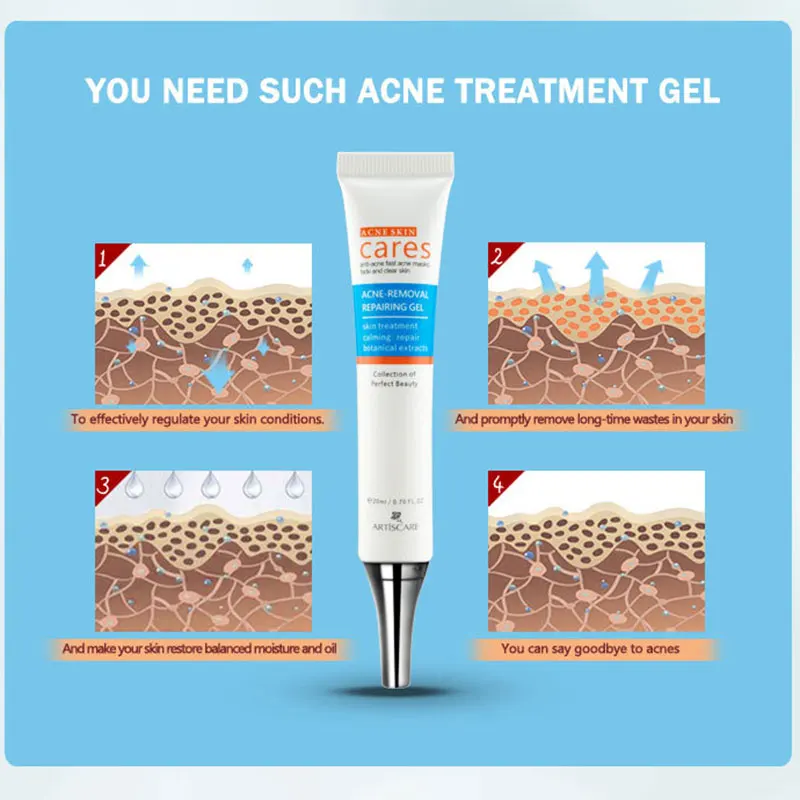 

20ml Mild Acne Cream Eliminate Skin Damage Treat Acne And Pimples Quickly Absorbed Moisturizing Brighten Firming Face Care