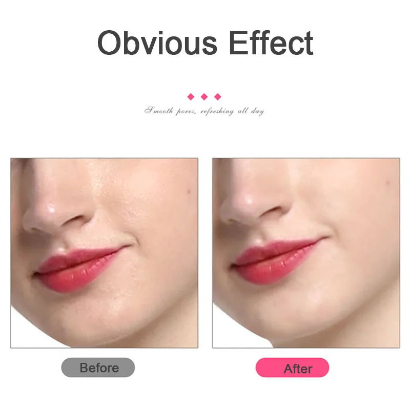 Ультразвуковой ионный шпатель для кожи лица|Устройства чистки лица| |