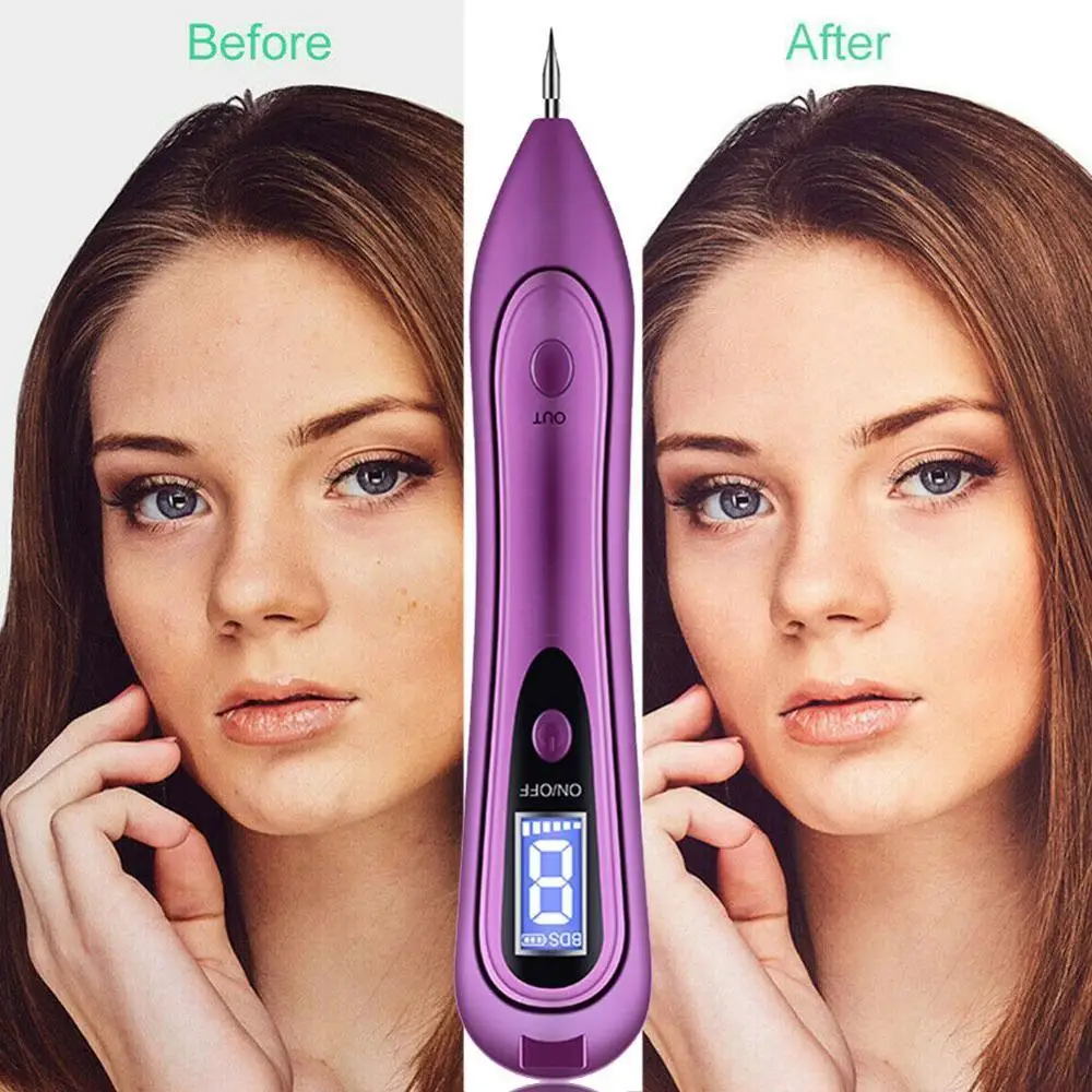 Средство для удаления кожи с биркой инструменты ухода за кожей бородавка родинка