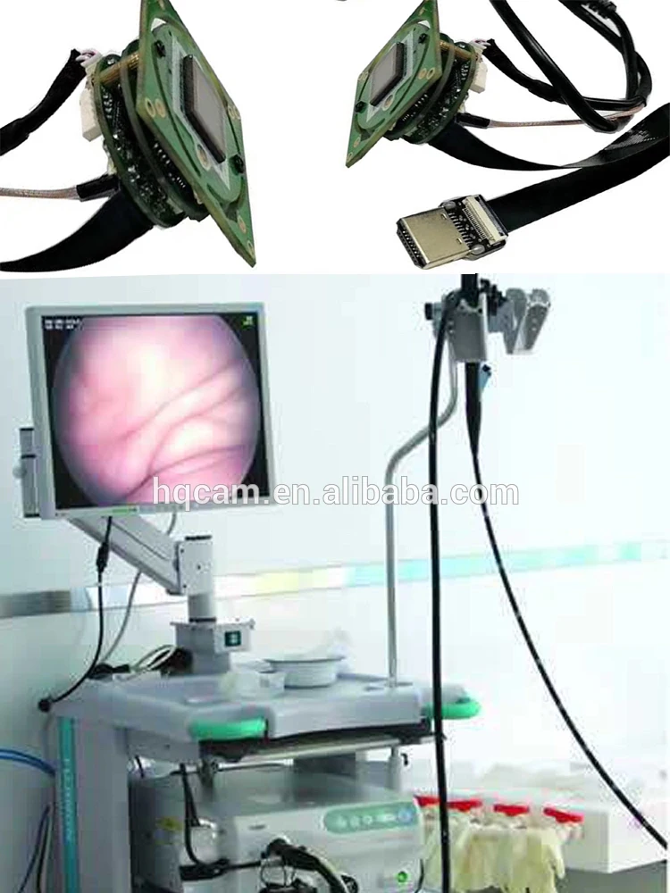 HDMI SDI 3G видео модуль камеры эндоскопа для глаз энт эндоскоп камера медицинская