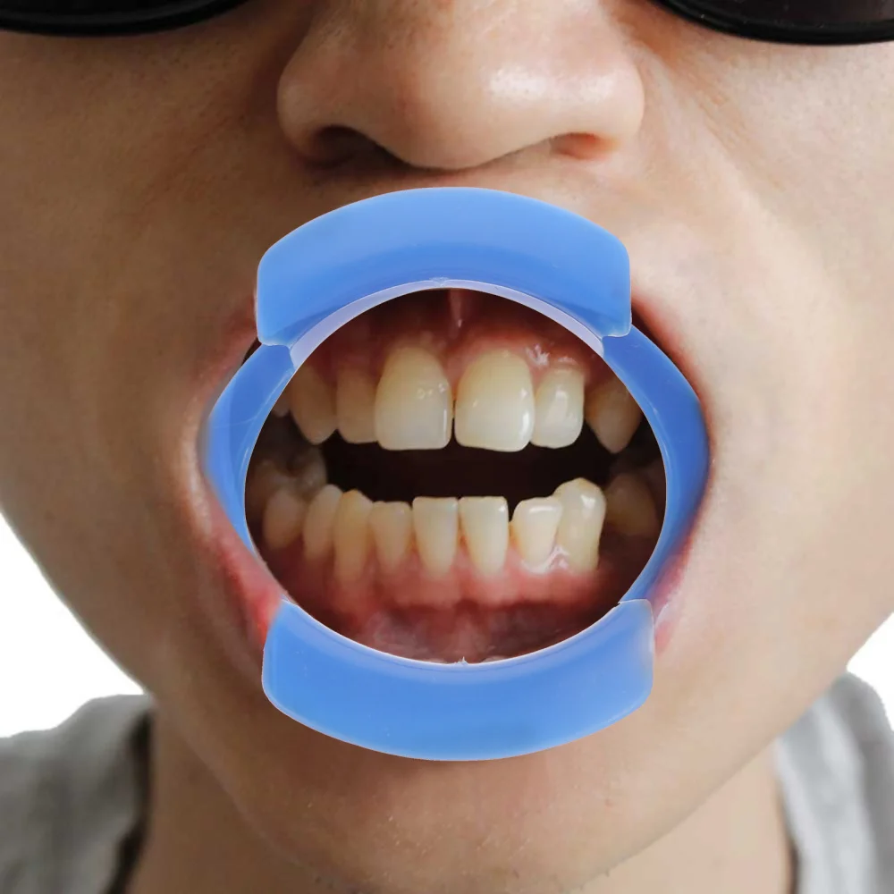 

12pcs O-Shaped Mouth Opener Mouth Opener Mouth Teeth Opening Tool