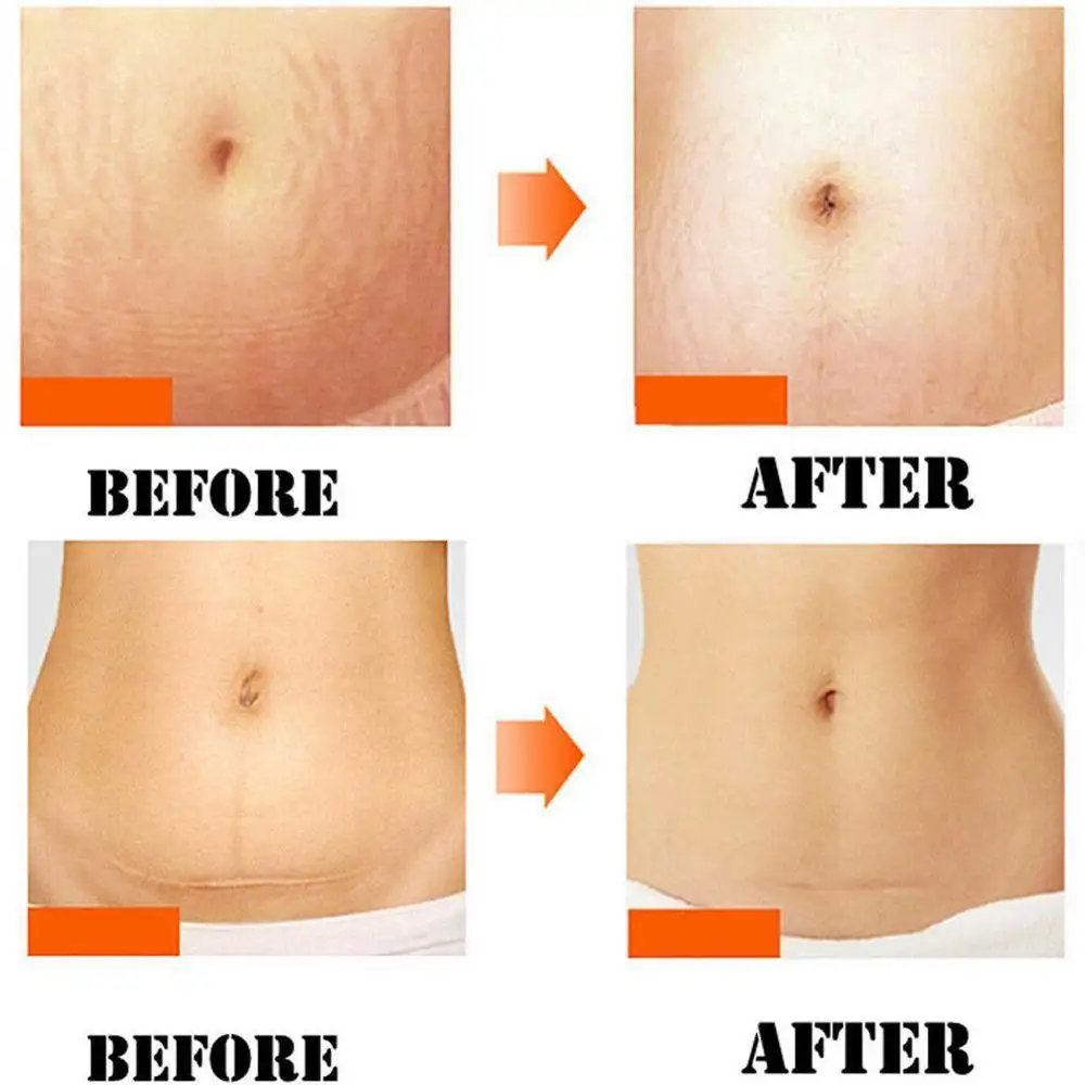 20 г уход за кожей тела восстанавливающий крем по уходу ребенком для удаления