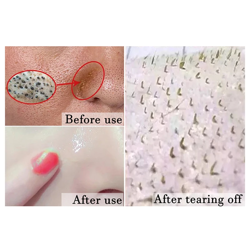 Blackhead удаление Глубокая чистка очищающий акне пилинг черная грязевая маска для