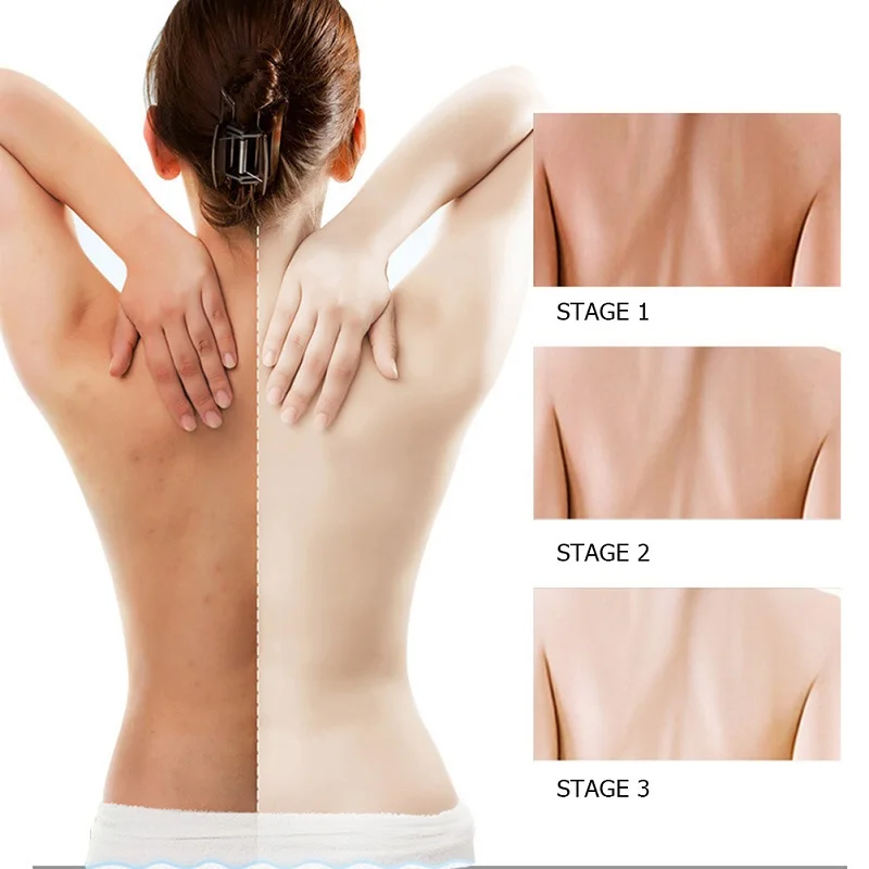 WXE вулканический грязевой гель для душа Весь Уход за телом быстрое глубокое