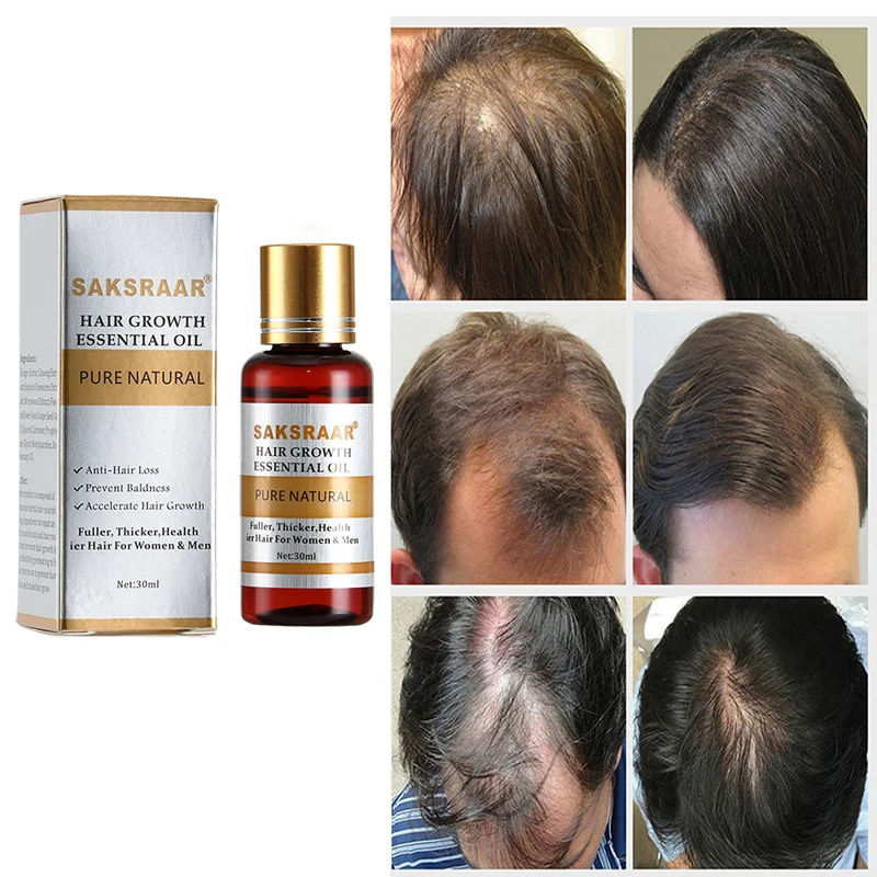 

Effective Hair Growth Serum Fast Thick for Hair Prevent Hair Loss Damaged Hair Repair Natural Hair Care Products