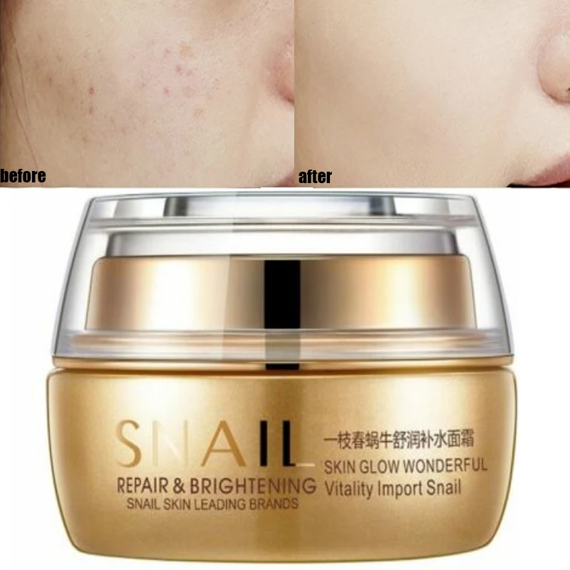 

Winter Moisturizing Face Cream Scar Remove creme Age Spot Pigment Whitening Anti Wrinkle Cream Beauty Miracle Glow Day Night