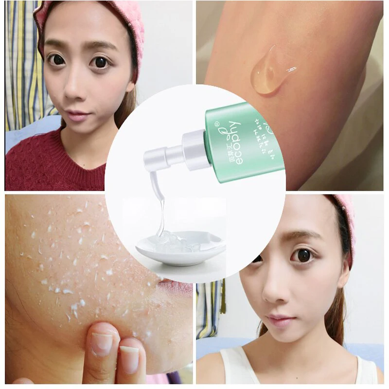 

Ecophy Acid Peeling Gel 120ml Facial Cleansing Exfoliating Peeling Scrub Deep Clean Acne Blackhead Remove Face Cleanser