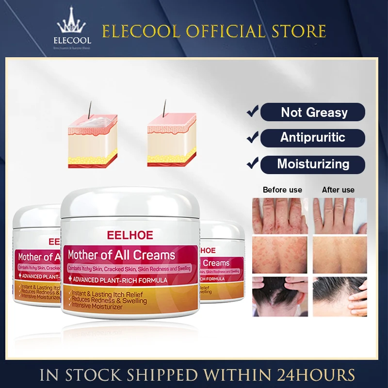 

Skin Psoriasis Cream Dermatitis Eczematoid Eczema Ointment Treatment Skin Rash Urticaria Desquamation Antibacterial Cream 50g