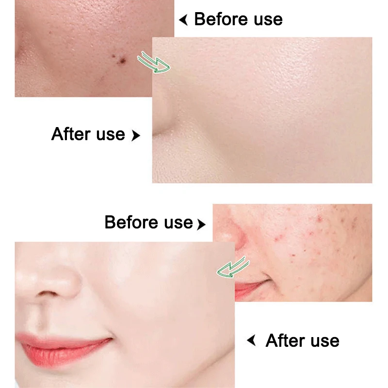 2021 Balancing Massage Cream Purifying Facial Hydration Deep Cleaning Detox Shrink Pores SSwell | Красота и здоровье