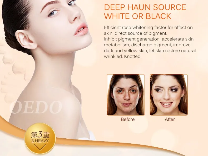 Розовая эмульсия содержит аргирелины Сыворотка против старения уход за кожей отбеливание увлажняющая эссенция для лица Осветление кожи ремонт лосьон