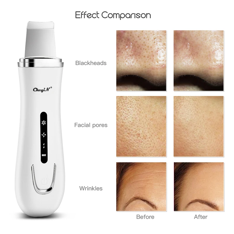 

Hot Ultrasonic Facial Skin Scrubber Electric Sonic Vibration Face Cleaner Dead Skin Blackhead Removal Shovel Comedone Extractor