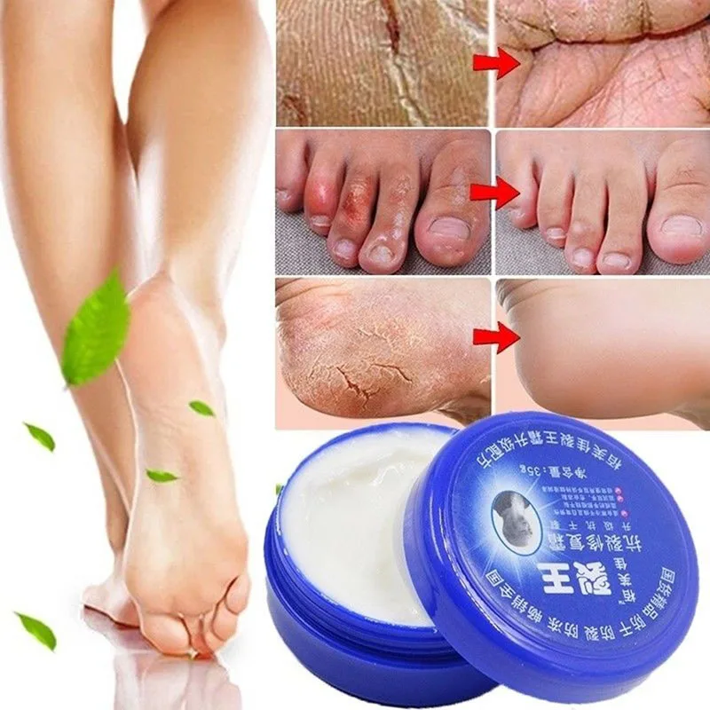 

Китайский бальзам отшелушивающий для рук от трещин на ногах крем на ороговевшей кожи пилинг для ног рука ремонт анти-сухая трещина по уходу ...