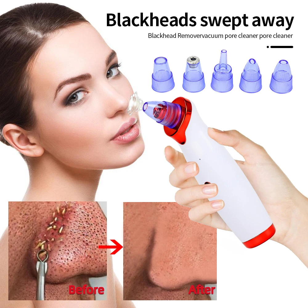 

Blackhead Remover Black Point Vacuum Deep Facial Cleansing Acne Black Spots Suction From Black Dots Beauty Clean Skin Tool
