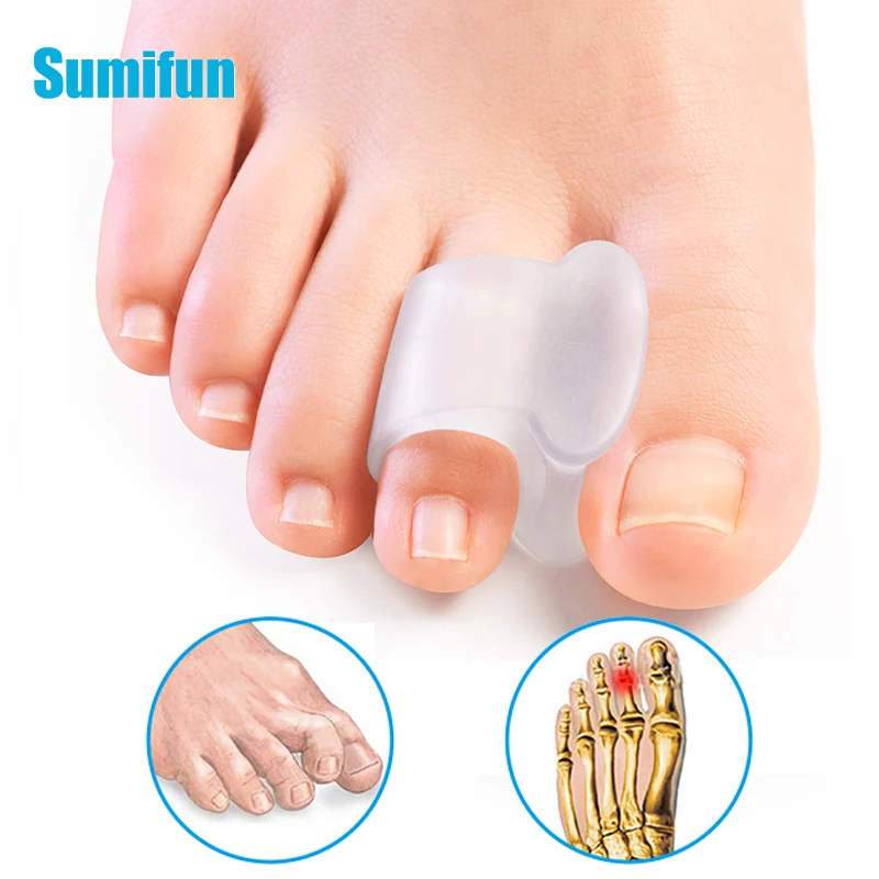20pcs Silicone Toe Separator Bunion Hallux Valgus Corrector Thumb Finger Correction Straightener Foot Care Pedicure Tools