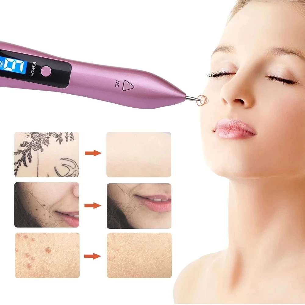 9 Level Spot Mole Removal Pen LED Plasma freckle Skin Tighenting Remover Wart Tag Tattoo Device | Красота и здоровье