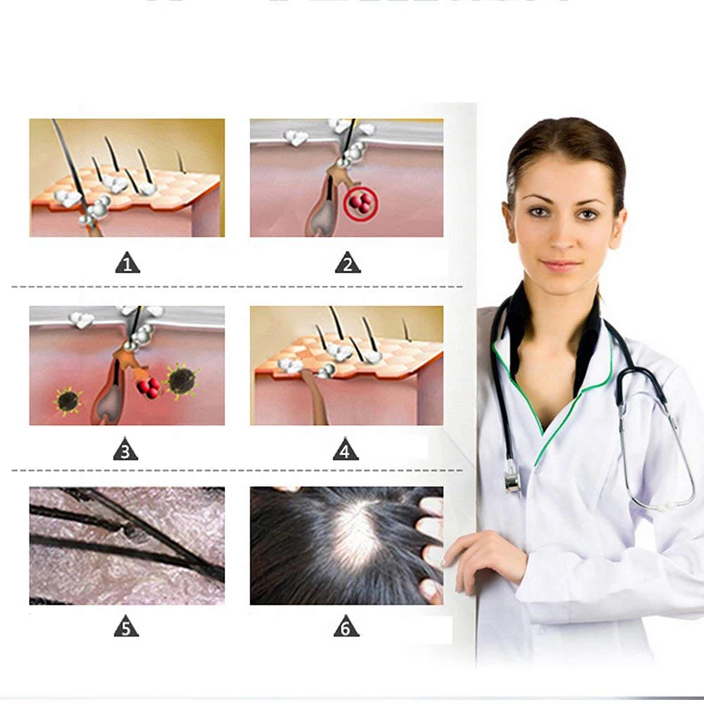 Продукты против выпадения волос Натуральное масло для роста маска имбирь