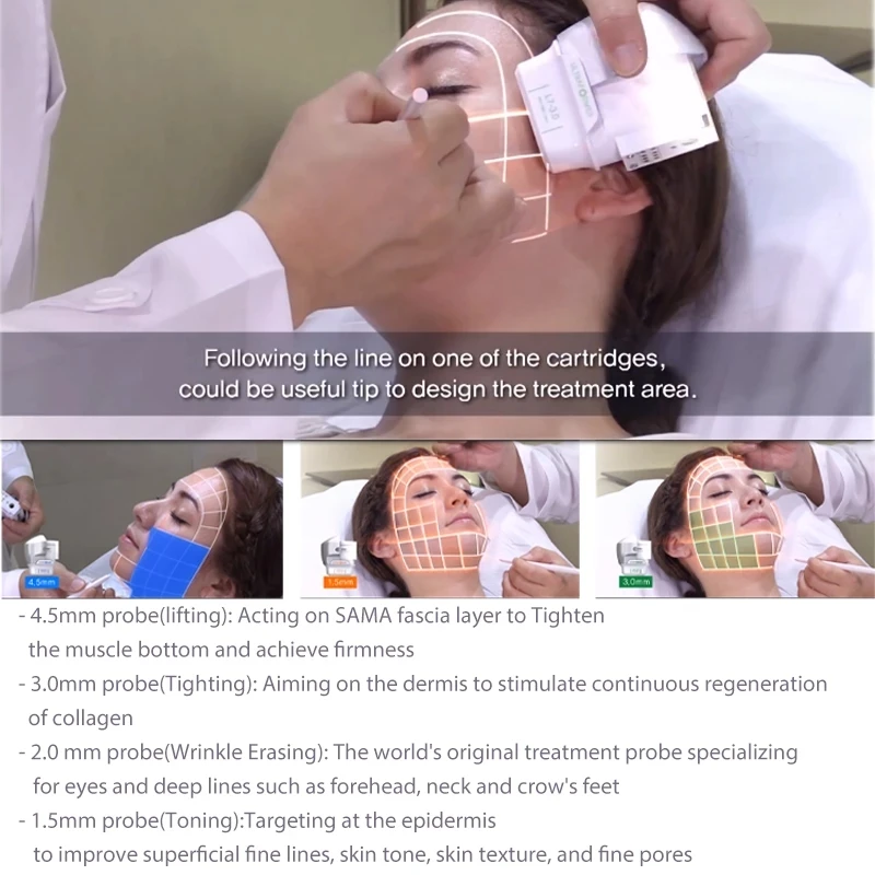 

7D ULTRA ultrasound machine antiwrinkle beauty equipment face and body treatment skin tighten machine