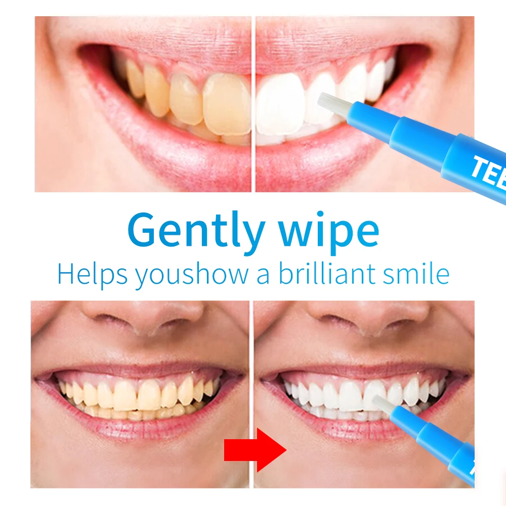 Ручка для отбеливания зубов LANBENA сыворотка устранения пятен на зубах гигиена