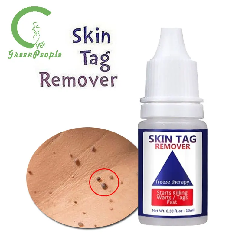 

10ml Genital Wart Treatment Papillomas Removal Of Warts Liquid From Skin Tags Removing Against Moles Remover Anti Verruca