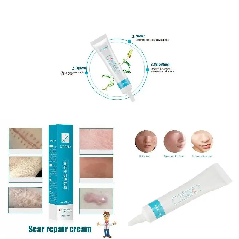 Новейший 20 г Крем для удаления шрамов увлажняющий крем мазь восстановления
