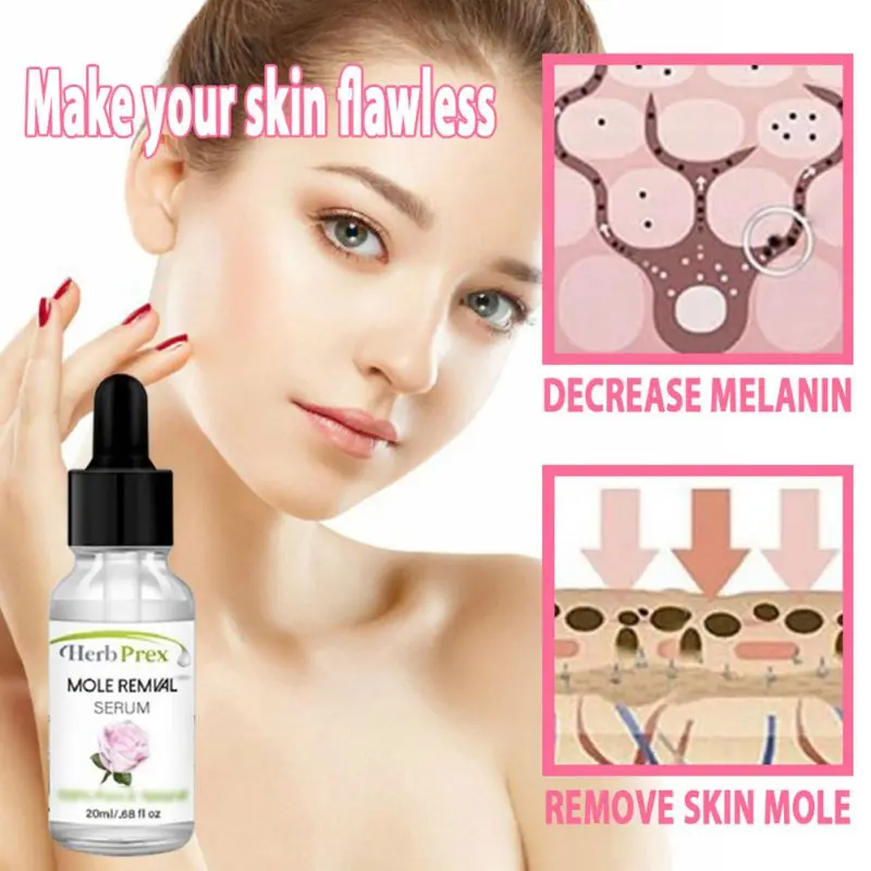 

Freckle Face Wart Tag Removal Cream Organic Skin Care Mole Freckle Spot No Trace Fast Oil Mole Removal Serum