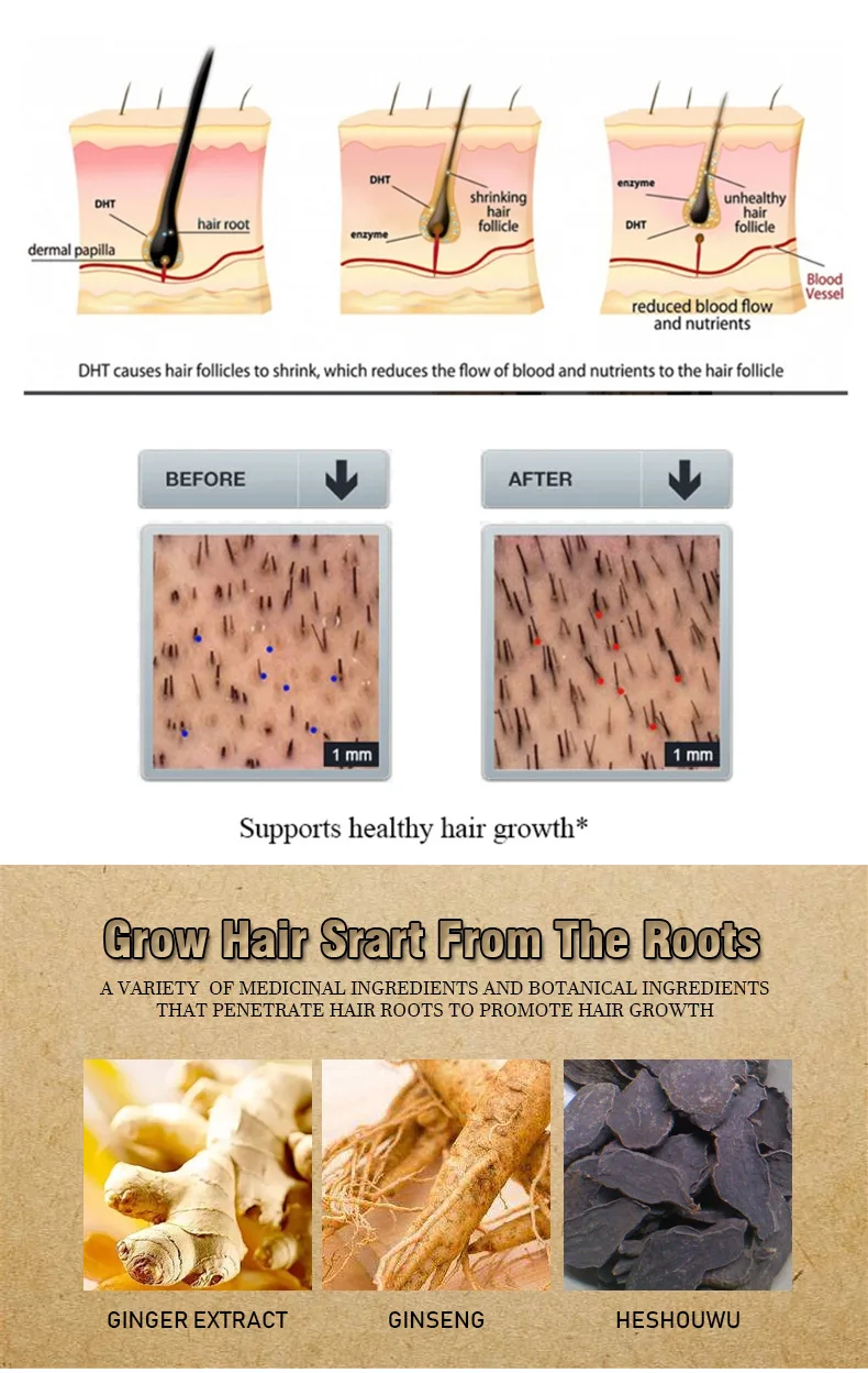 

Ginger Prevent Hair Loss Product Hair Growth Essential Oil Easy To Carry Hair Care Nursing 35ml Both Male And Female Can Use
