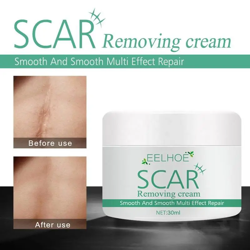 30ML Acne Scar Removal Cream Repair Acne Spots Acne Treatment Blackhead Whitening Shrink Pores Stretch Marks Skin Care