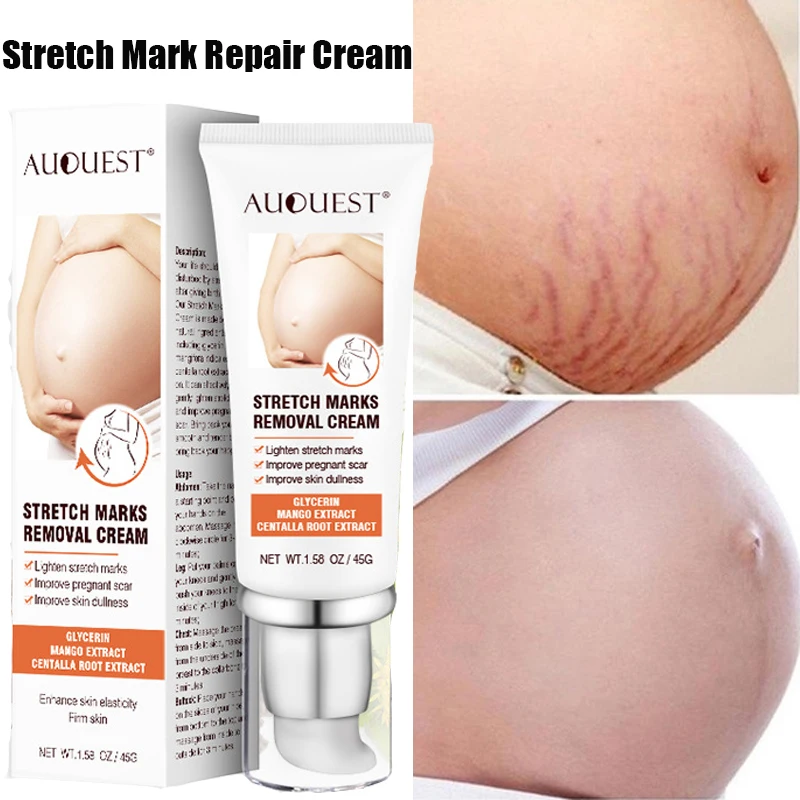 

45g Pregnancy Repair Cream Firming Cream Stretch Mark Removal Removal Acne Scar Stretch Marks Cream Fat Striae Body Care Creams