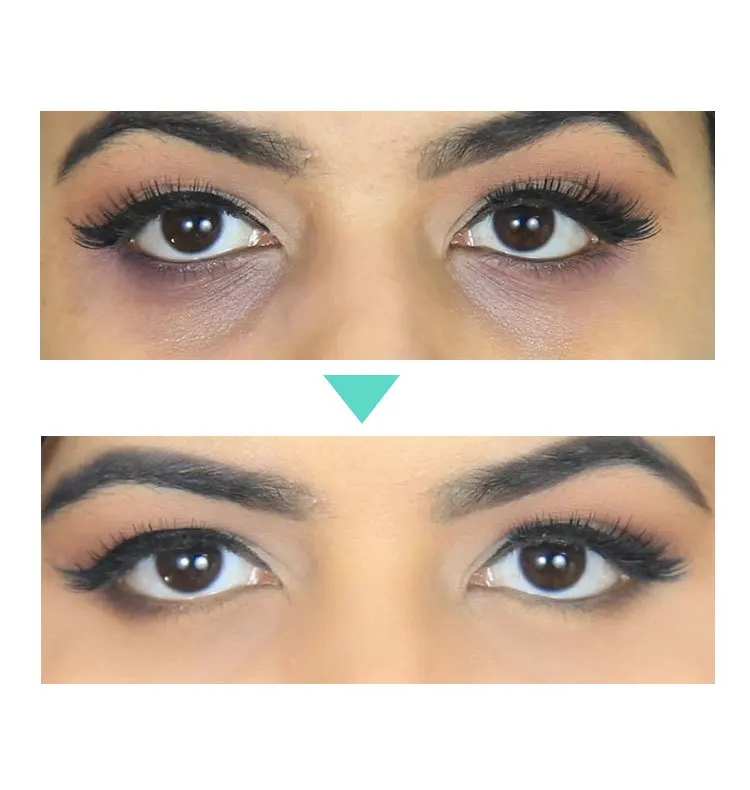 Instant Remove Eye bags Cream Retinol Anti Puffiness Gel Dark Circles Delays aging fades wrinkles Firming Brighten Skin |